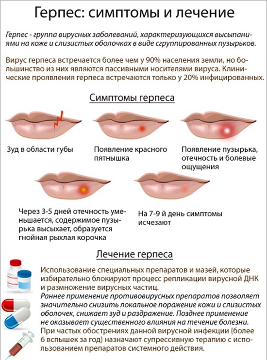 Герпес на губах симптомы и лечение